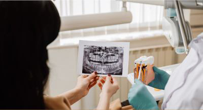Smile makeover cosmetic dentistry at Newport Beach Dental Center