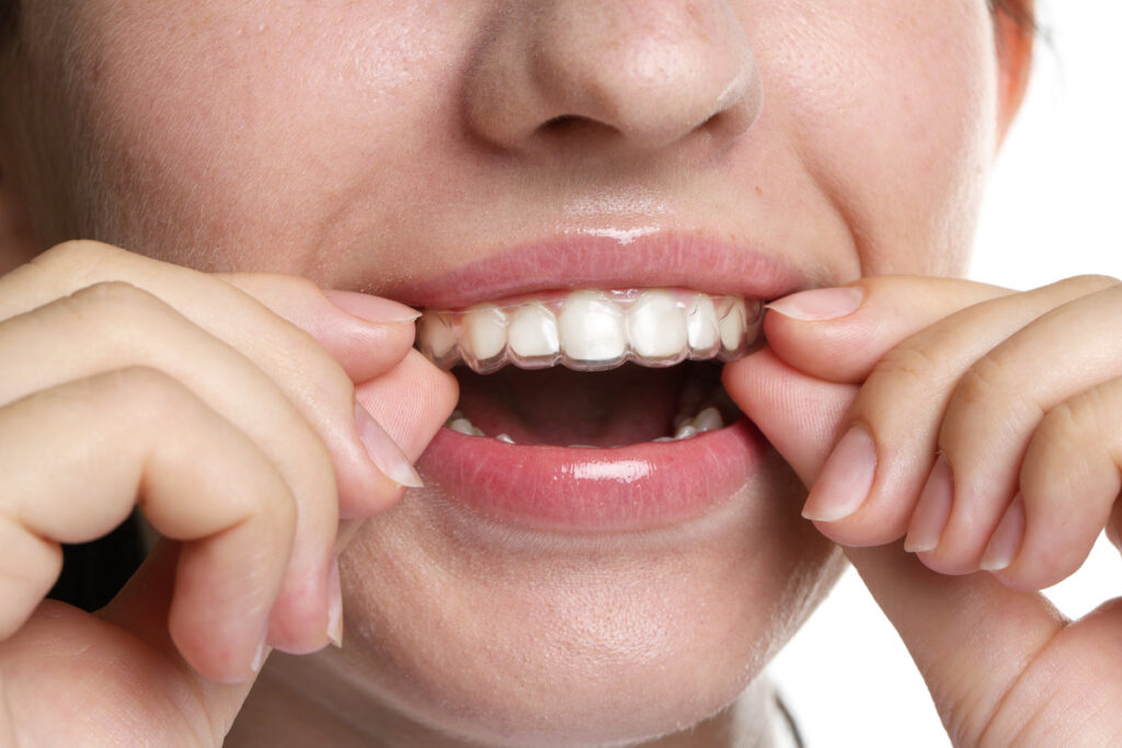 Woman wearing dental aligner on white background, closeup